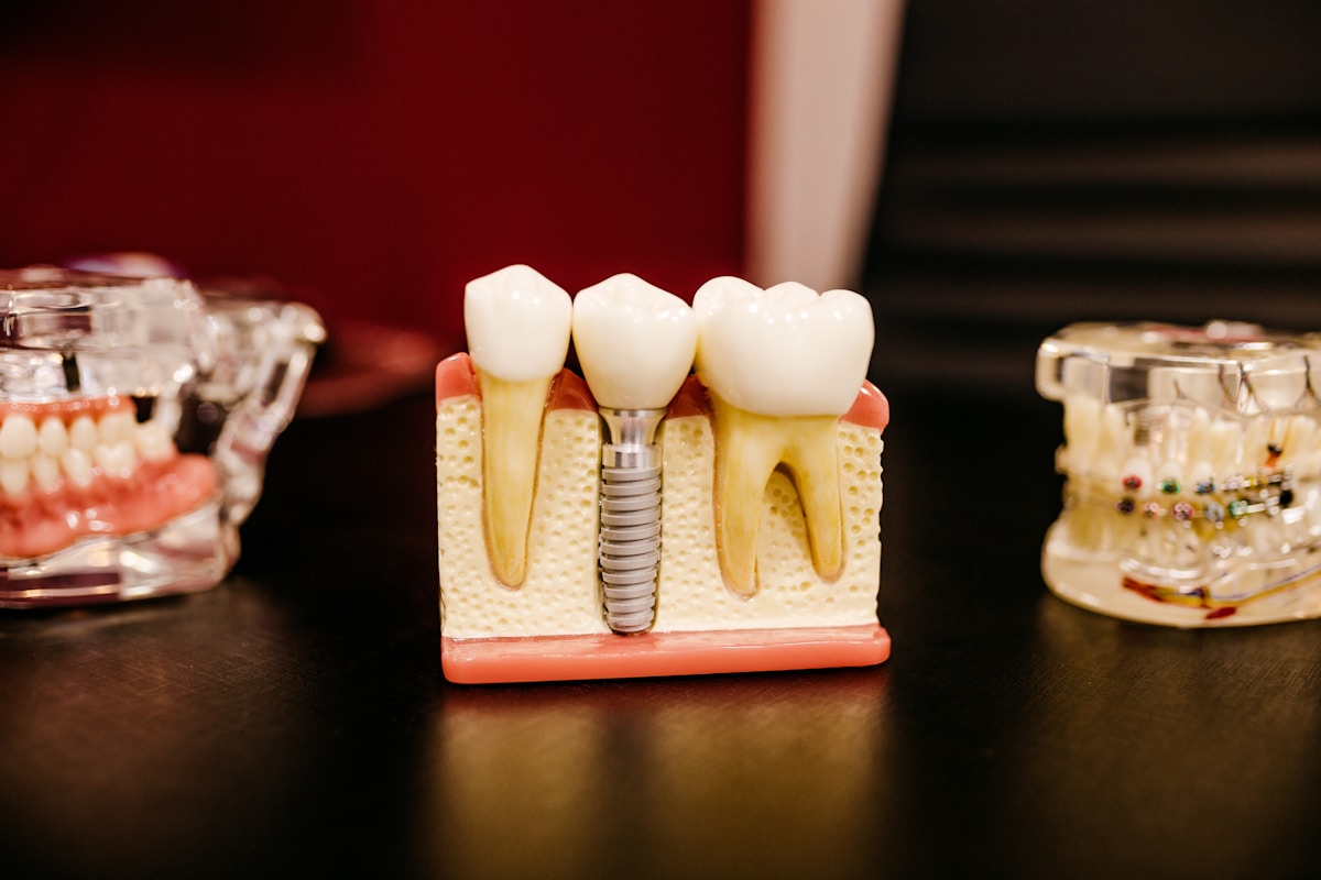 Modelo de implante dental utilizado en los tratamientos de la clínica