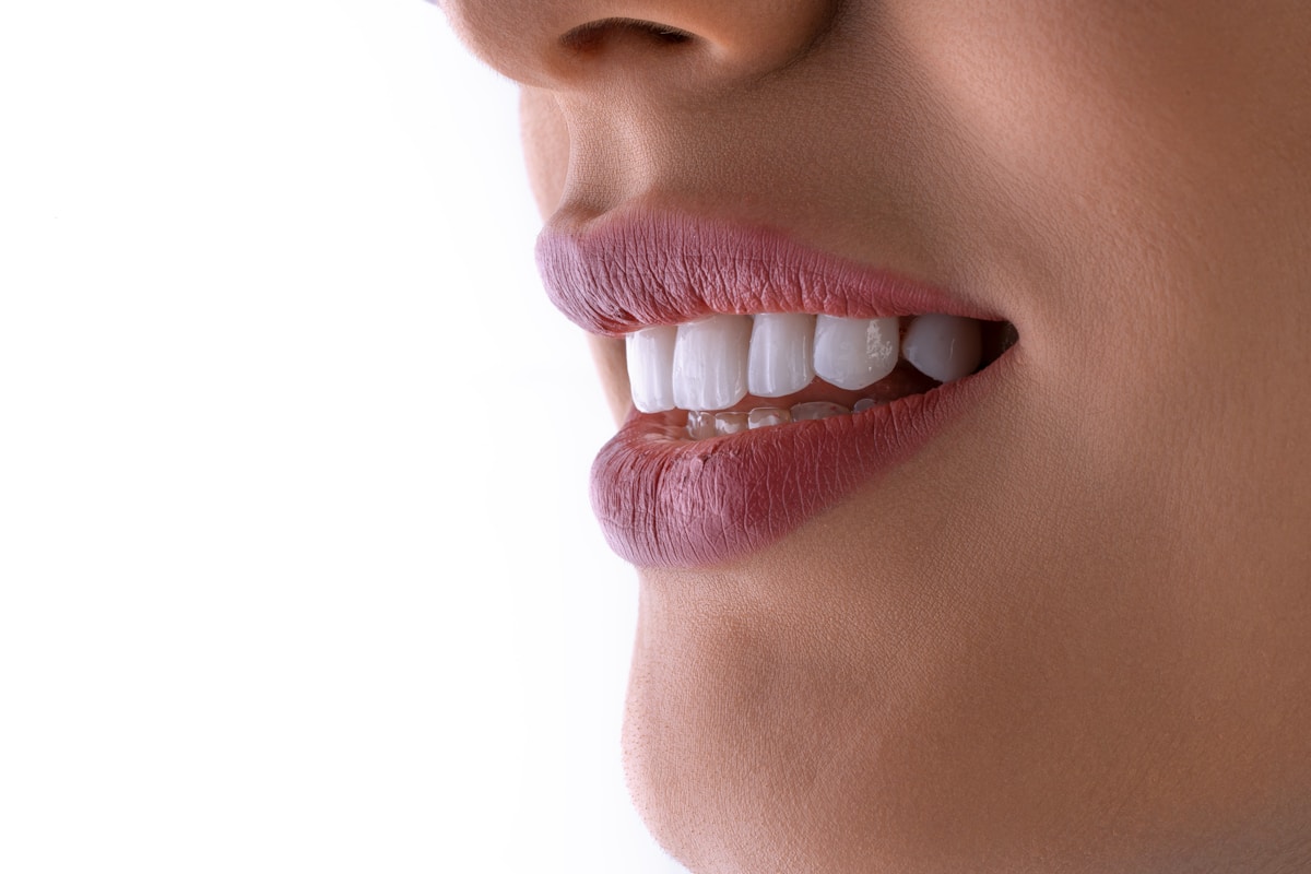 Resultado de tratamiento dental: sonrisa cuidada y natural