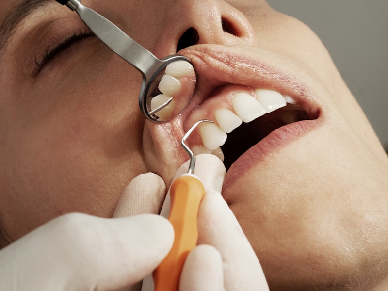 Revisión y limpieza dental profesional en Clínica Villa